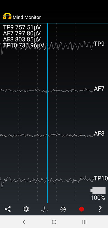 Screenshot_20210904-230143_Mind Monitorsm2.jpg