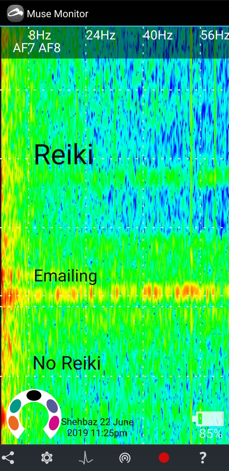 EEG Spectrogram